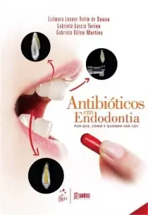 Antibiótico em Endodontia - Por Que, Como e Quando Usá-los - 01Ed/14