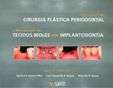 Atlas Clínico de Cirurgia Plástica Periodontal e Manip. de Tecidos Moles em Implantodontia - 01Ed/07