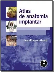 Atlas De Anatomia Implantar  1Ed.
