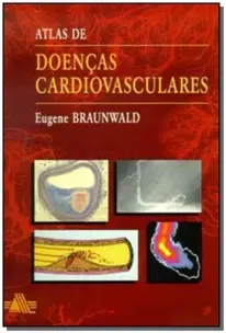 Atlas De Doenças Cardiovasculares